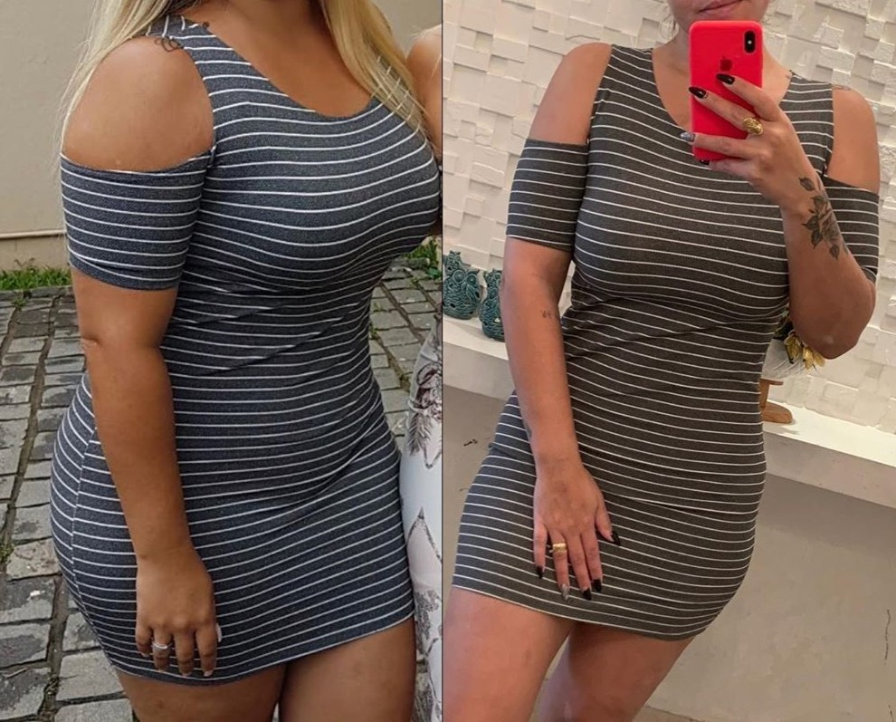 Patrícia antes e depois